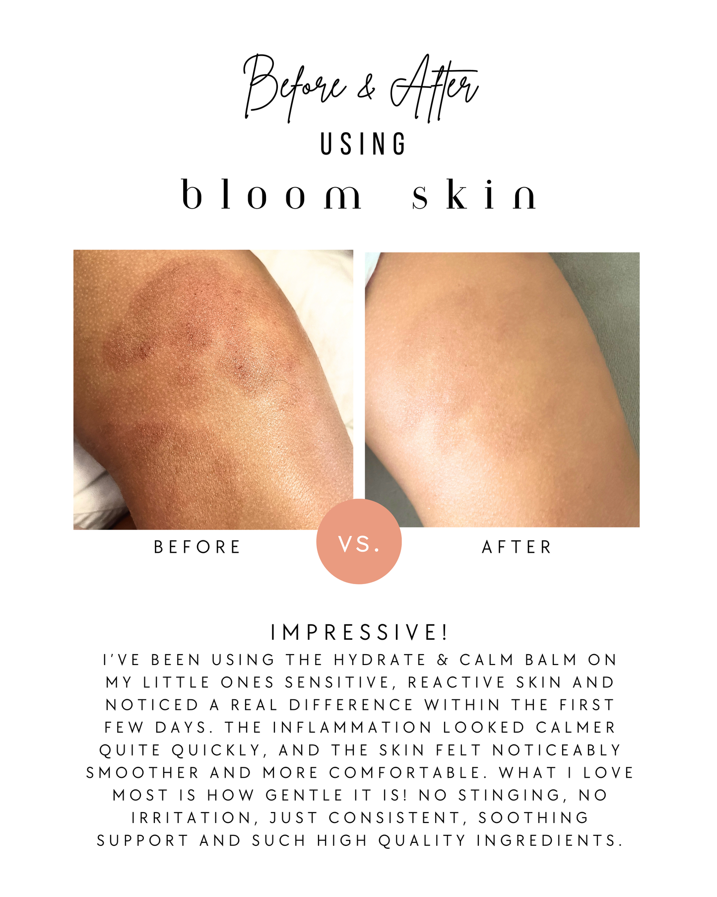 Hydrate & Calm Balm (was Baby & Child Balm)