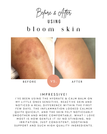 Hydrate & Calm Balm (was Baby & Child Balm)