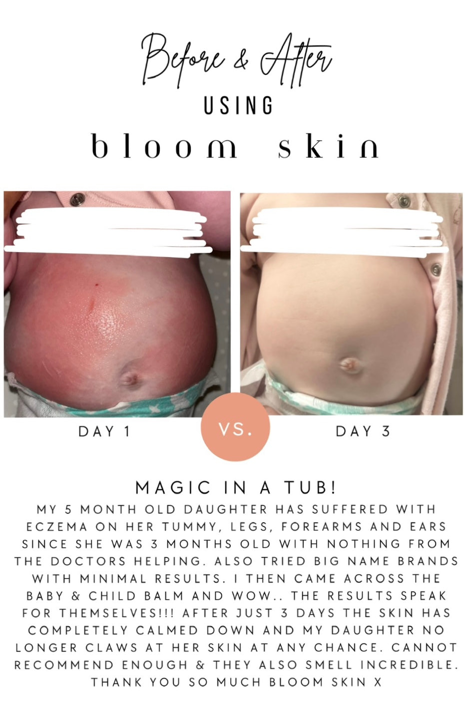 Hydrate & Calm Balm (was Baby & Child Balm)