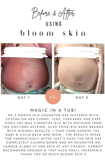 Hydrate & Calm Balm (was Baby & Child Balm)